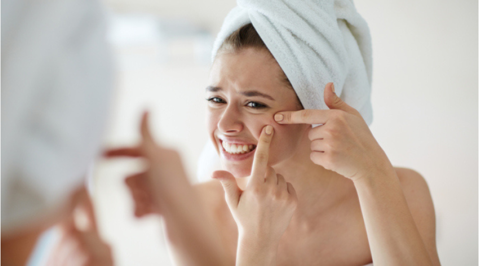 Acne e sole: cosa bisogna sapere? 